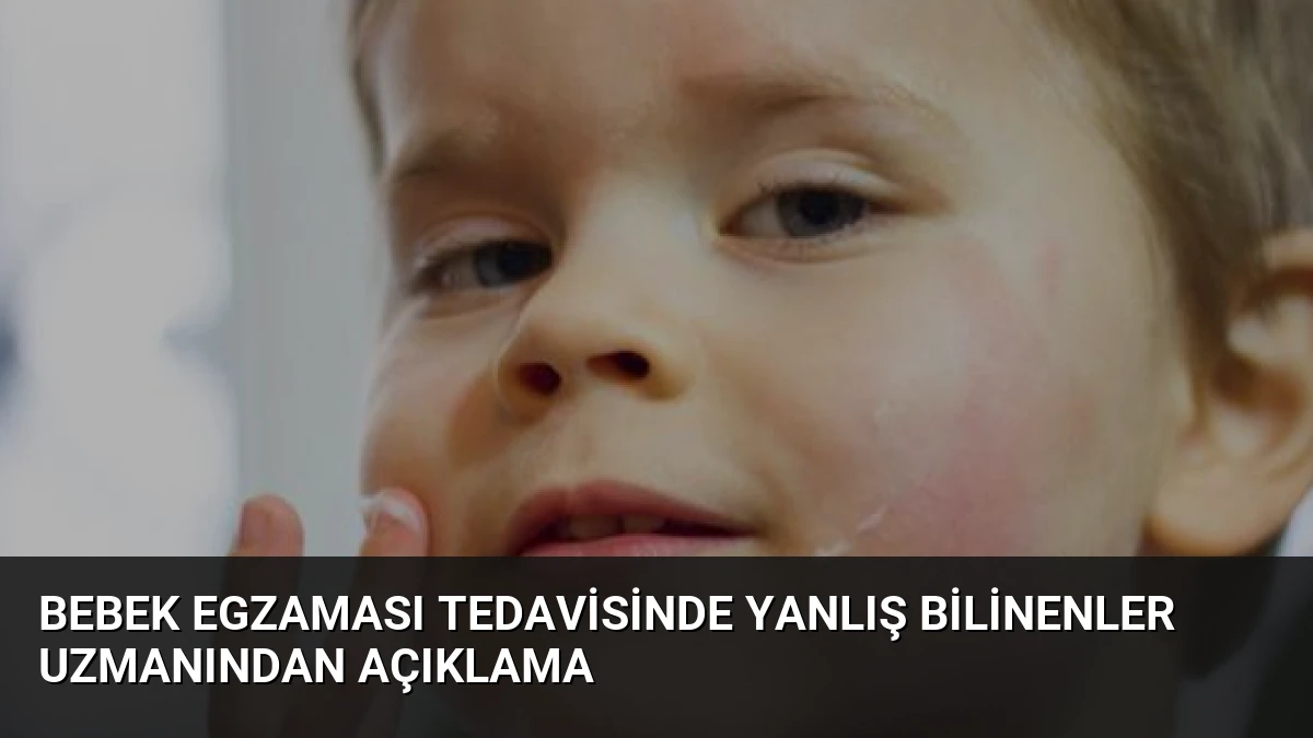 Bebek Egzaması Tedavisinde Yanlış Bilinenler Uzmanından Açıklama