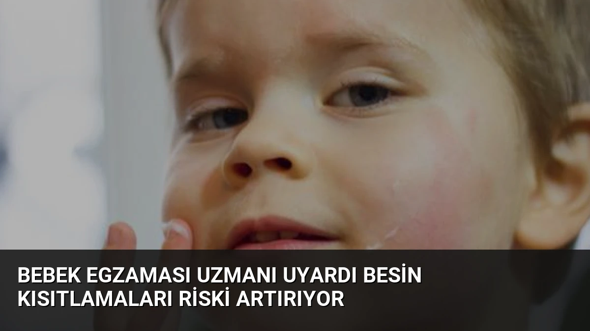 Bebek Egzaması Uzmanı Uyardı Besin Kısıtlamaları Riski Artırıyor