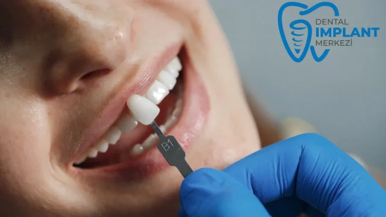 Dental Merkez İmplant Yaklaşımı ve Kapsamlı Hizmet Modeli Nedir?